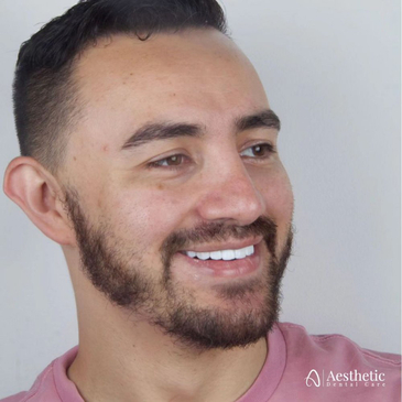 Slider image (5) Aesthetic Dental Care Costa Rica